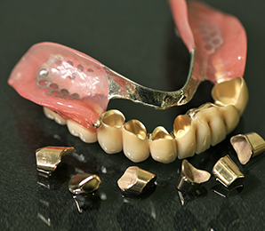 コーヌステレスコープについて