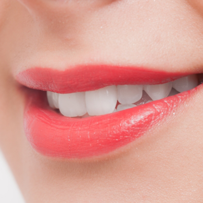 セラミックについて