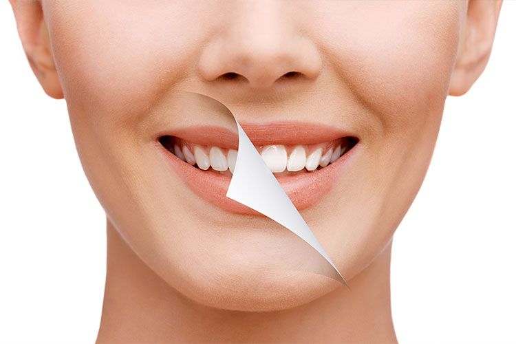 歯の変色　（原因と対策）　