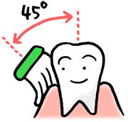 あなたもインプラント周囲炎になってるかも、、、インプラント周囲の磨き方について‼現役歯科衛生士が教えます！