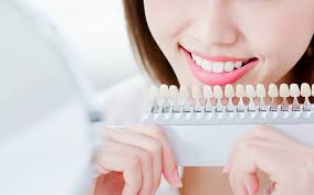 ホワイトニングってなに？（ホワイトニングは効果ある？）