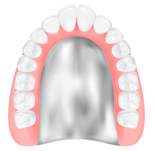 チタン／コバルトクロム床義歯のイメージイラスト