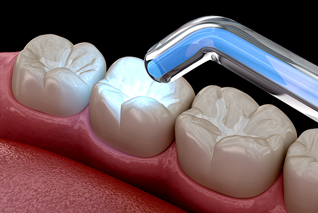 シーラントのイメージ画像