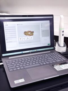 デジタルスキャナーで、歯科治療がもっと快適に